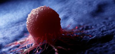 3d rendered medically accurate illustration of a cancer cell