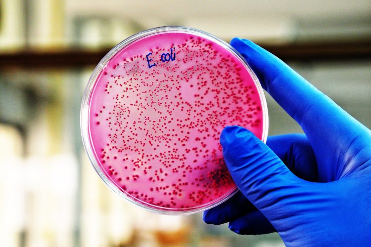 A scientist is holding a plate of E. Coli growing on selective agar media in microbiology laboratory