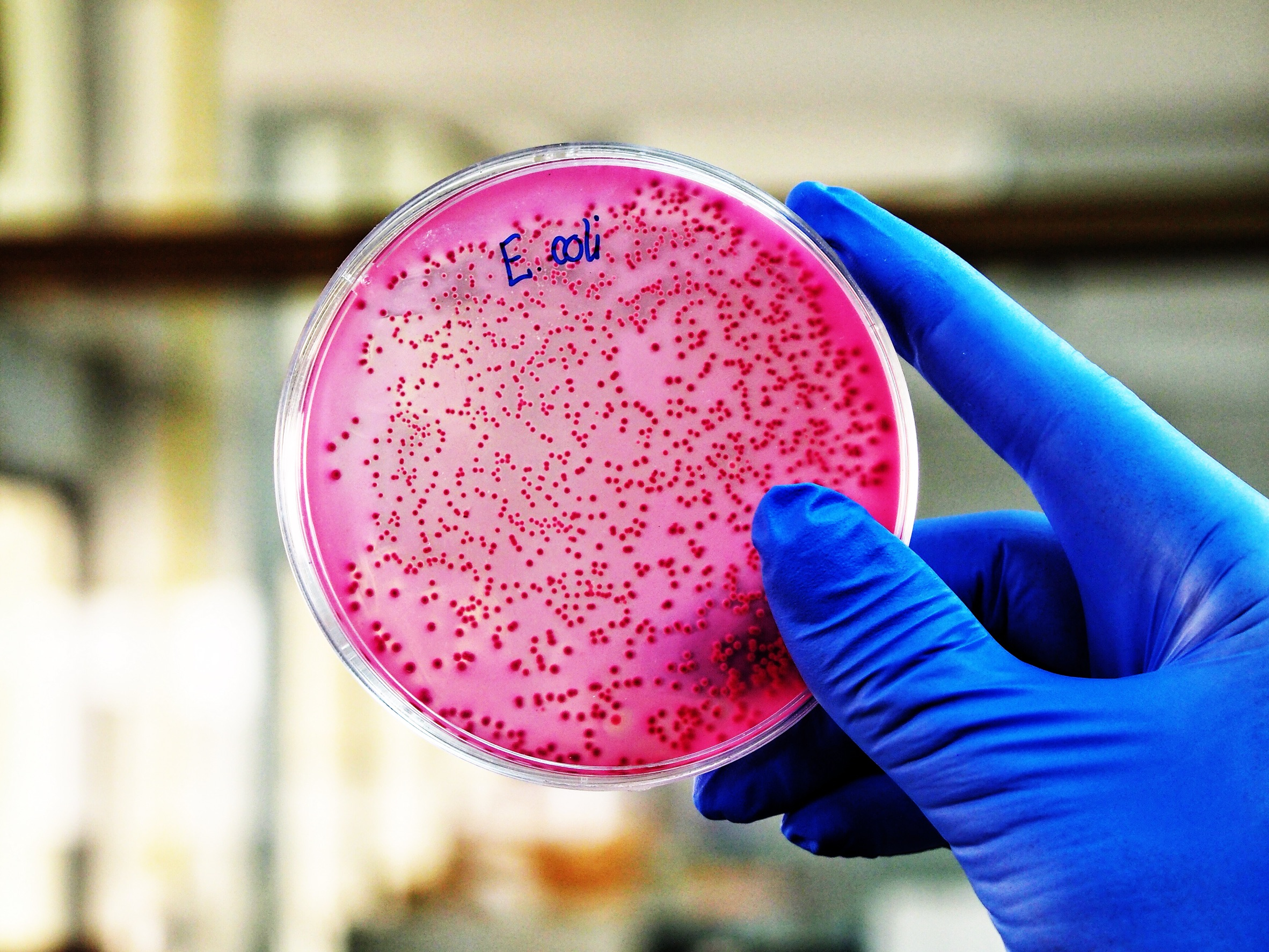 A scientist is holding a plate of E. Coli growing on selective agar media in microbiology laboratory