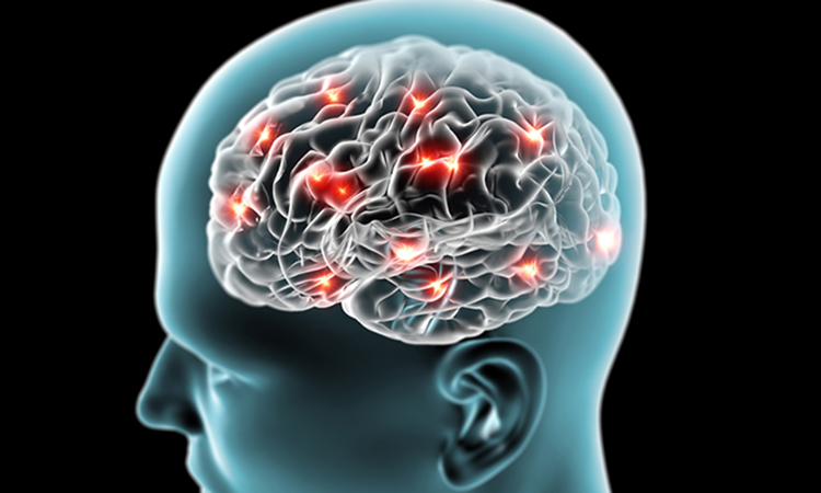 neuroinflammation