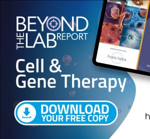 Beyond the Lab Cell Therapy