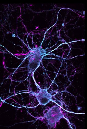 neuron treated with the ibogaine analogue (-)-10-fluoroibogamine