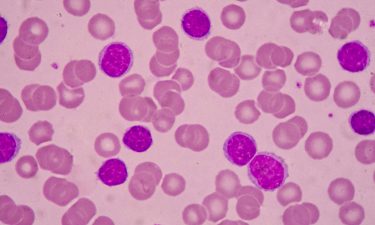 Pathway to combat chronic myelogenous leukaemia identified in study