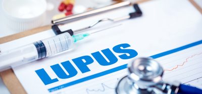 Lupus