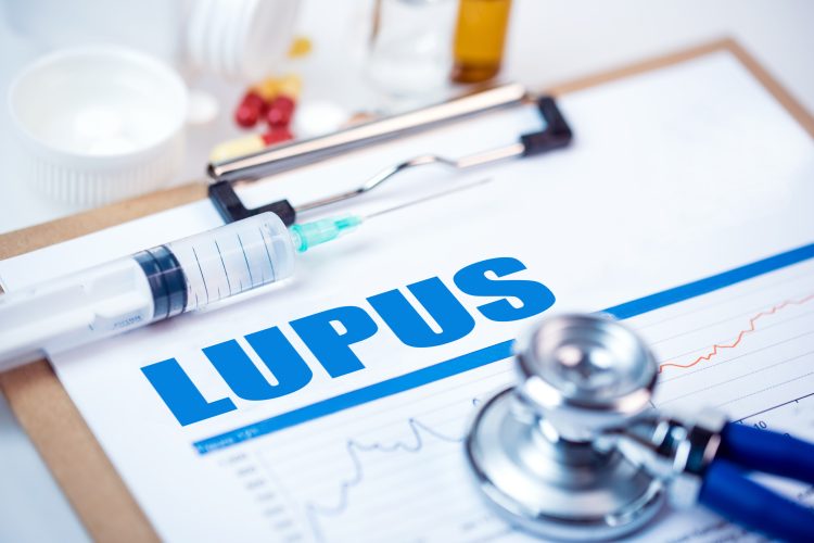 Lupus