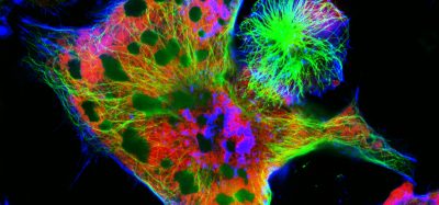 Neuroblastoma cells: nuclei are stained in red, microfilaments are in green and blue.