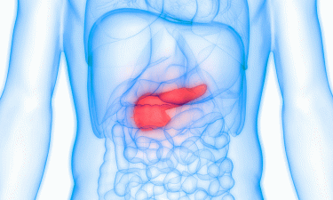 Tongue microbiome could help to detect early-stage pancreatic cancer