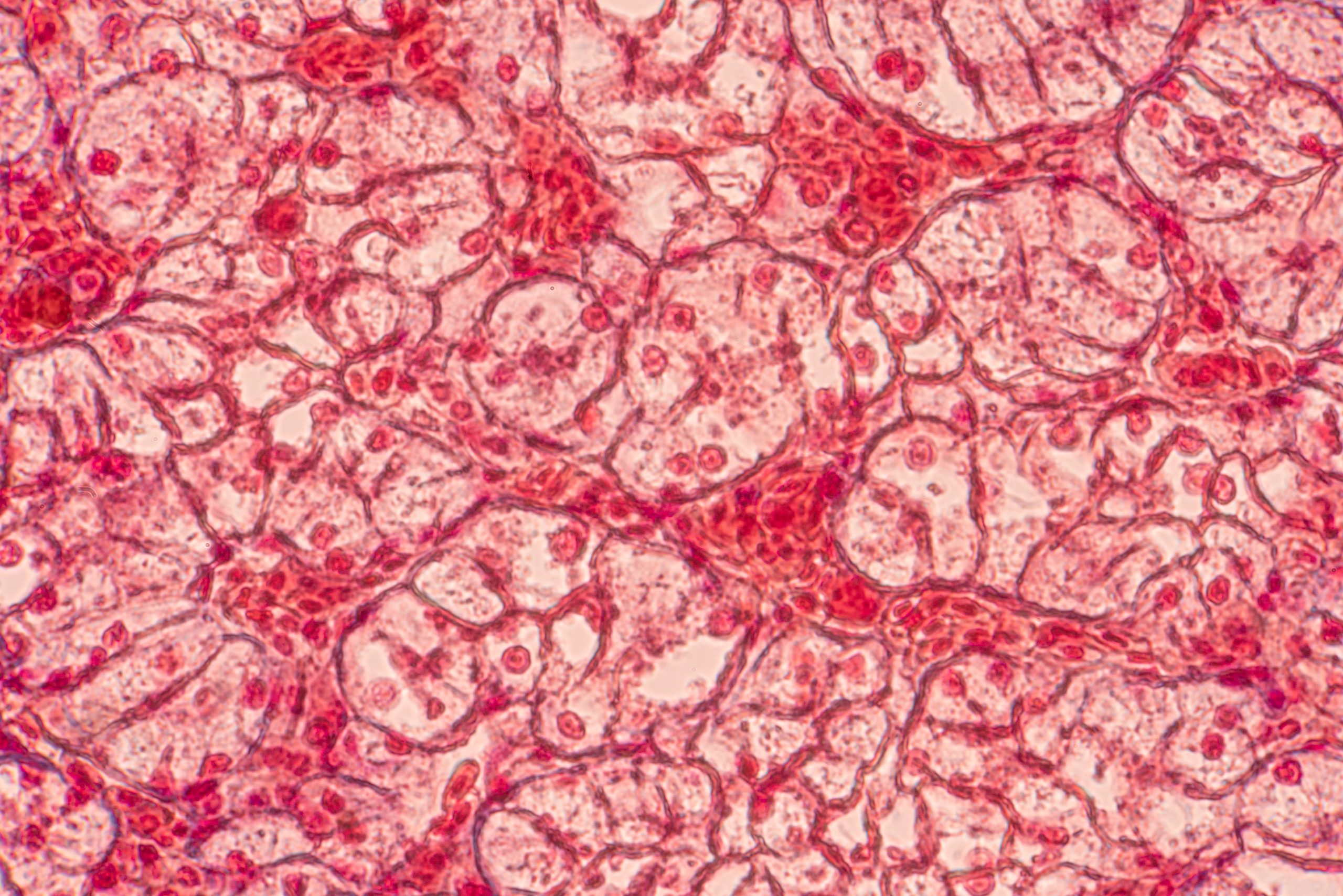 epithelial cells