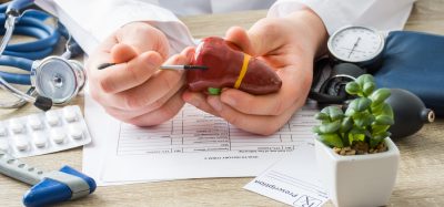 At doctors appointment physician shows to patient shape of liver with focus on hand with organ. Scene explaining patient causes and localization of diseases of liver, hepatobiliary system, gallbladder