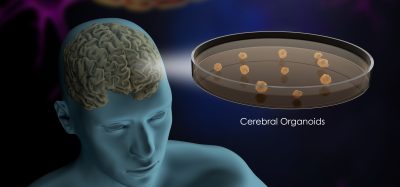 Cerebral organoids