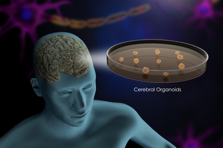 Cerebral organoids