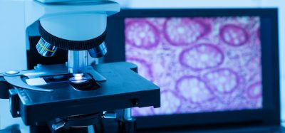 Modern microscope and human tissue section slide with computer monitor show glandular image.Medical patholology and cytologytechnology concept.