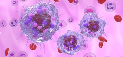 euroendocrine tumor cells