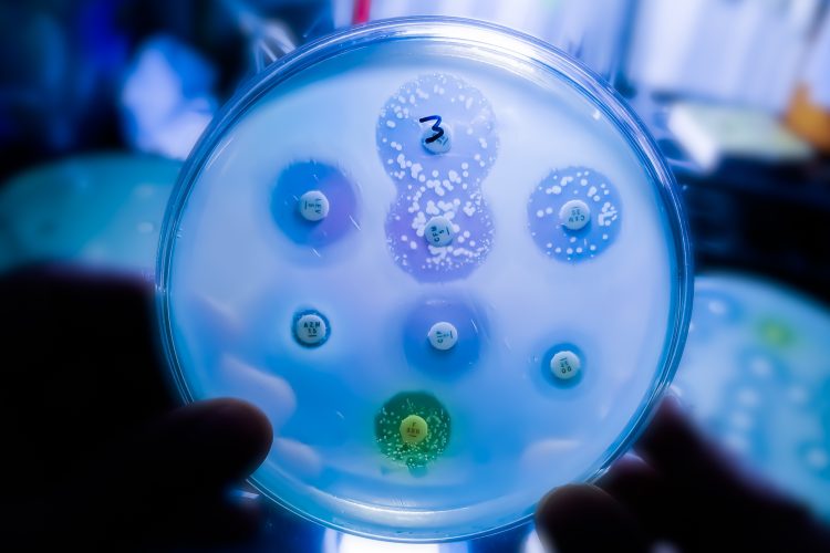 Antimicrobial susceptibility testing in petri dish. Microbiologist check Antibiotic resistance of bacteria