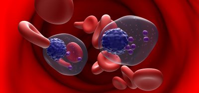 Multiple myeloma cells (MM) in blood flow