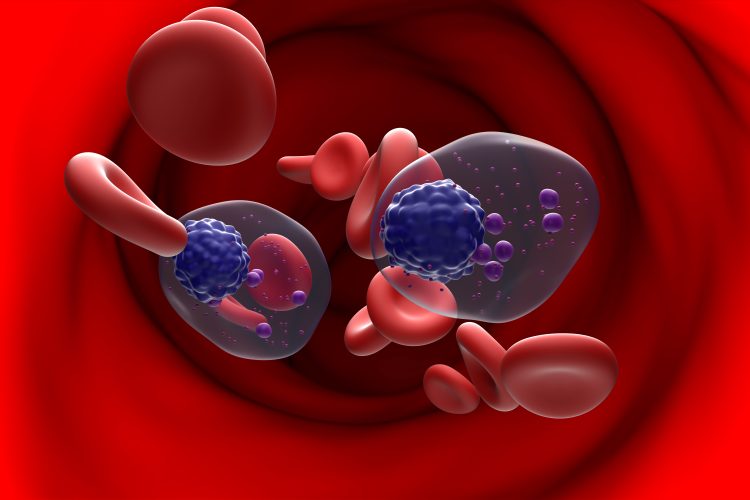 Multiple myeloma cells (MM) in blood flow