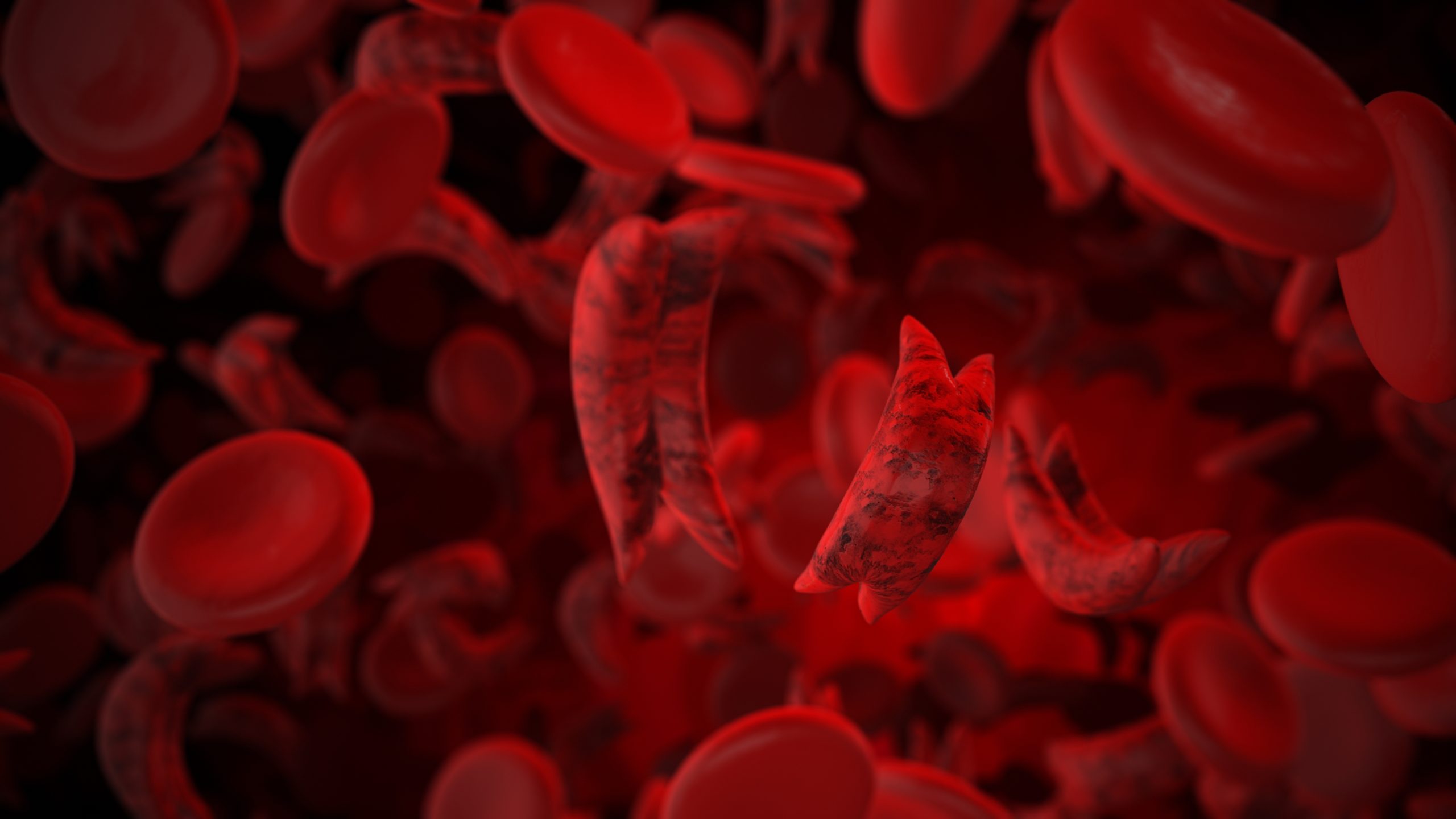 Sickle cell disease medical concept 3D Illustration