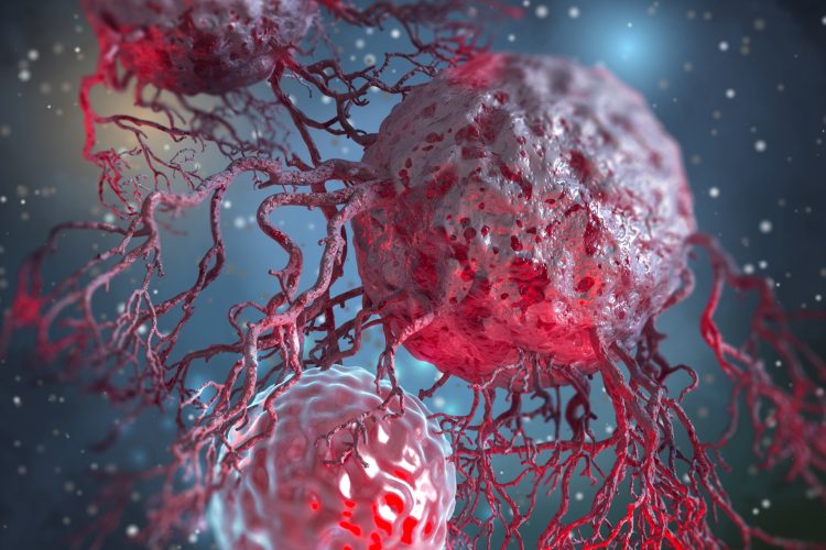 cancer cell metastasis
