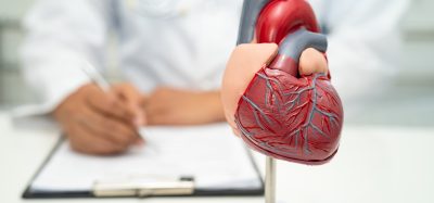 doctor holding human anatomy model for learn and treat heart disease.