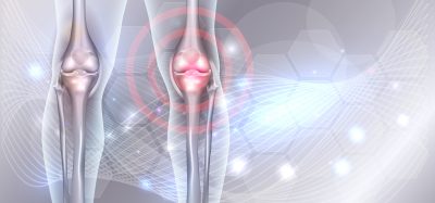 Biomaterial used for bone regeneration