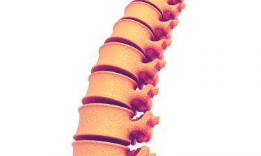 Researchers develop new system to detect spinal deformity